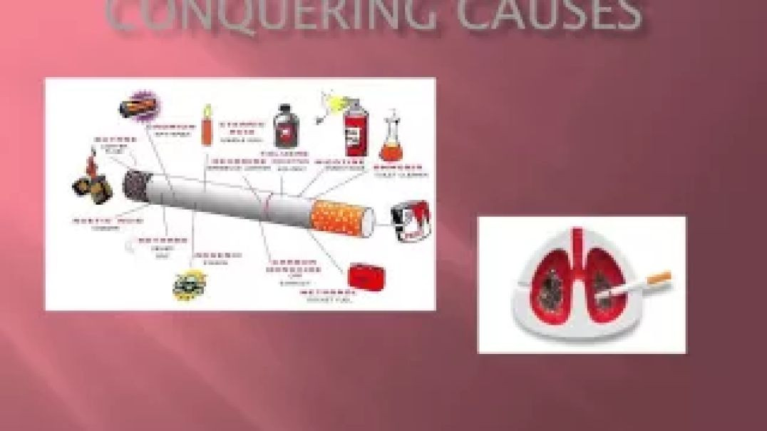 Cancer Class 4 - Conquering Causes