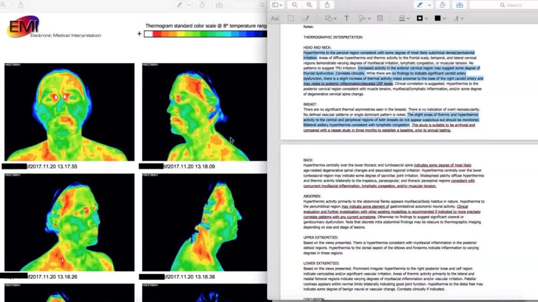 ⁣Thermography Review