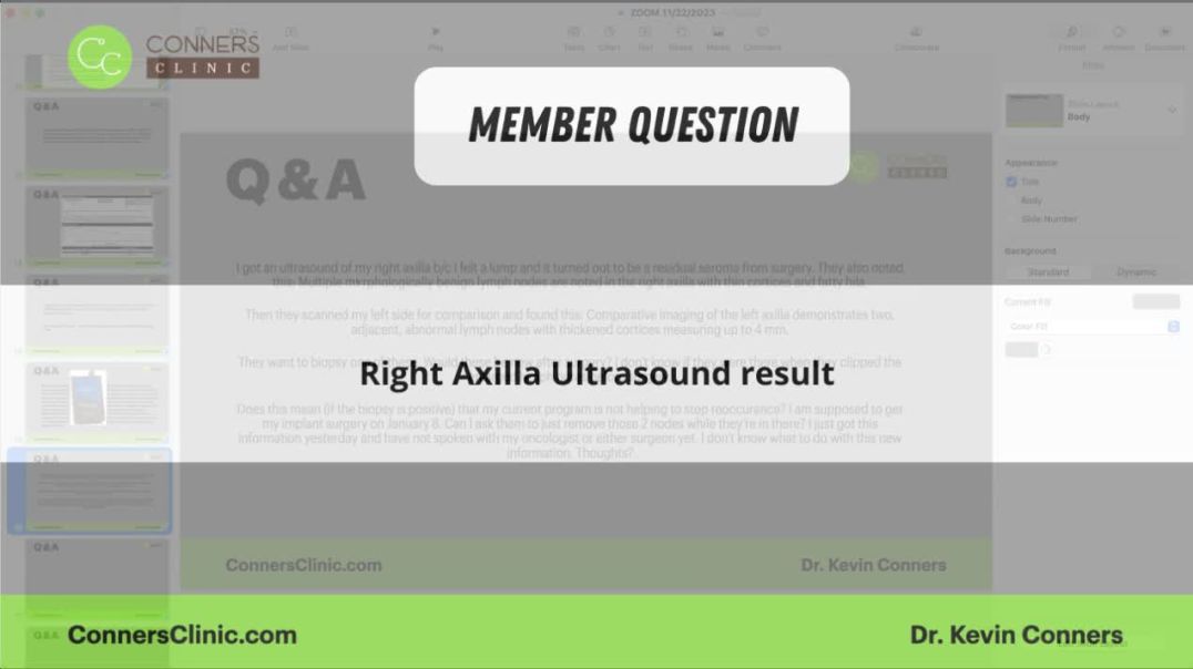 ⁣Right Axilla Ultrasound Result