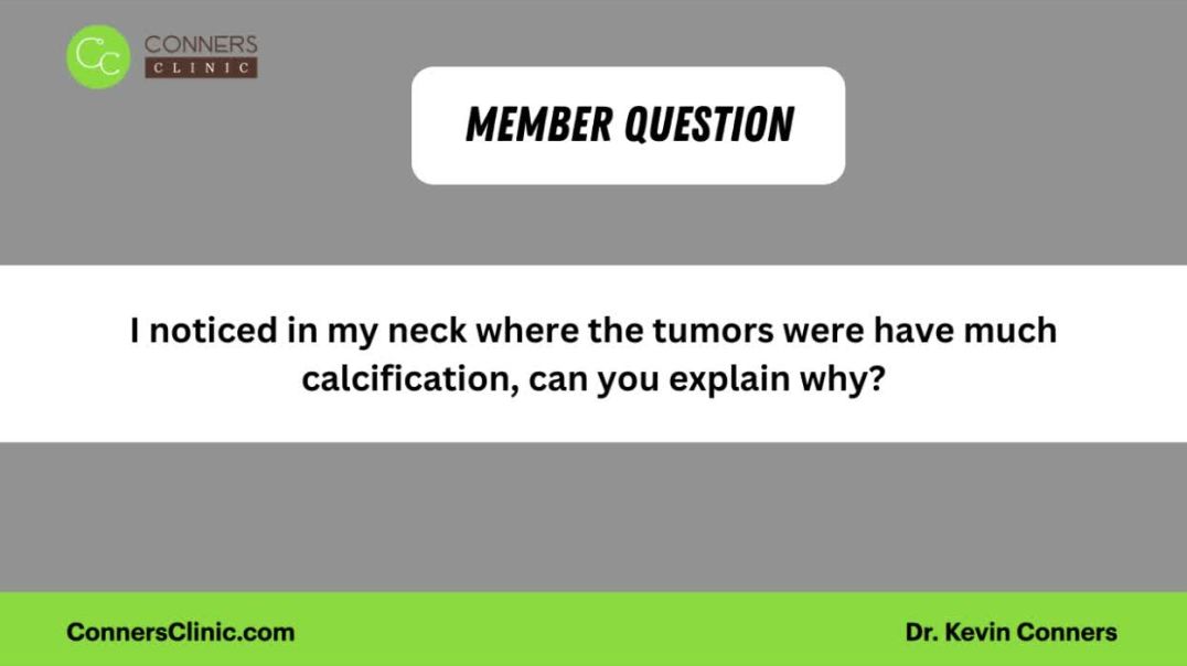 Calcification of lymph nodes