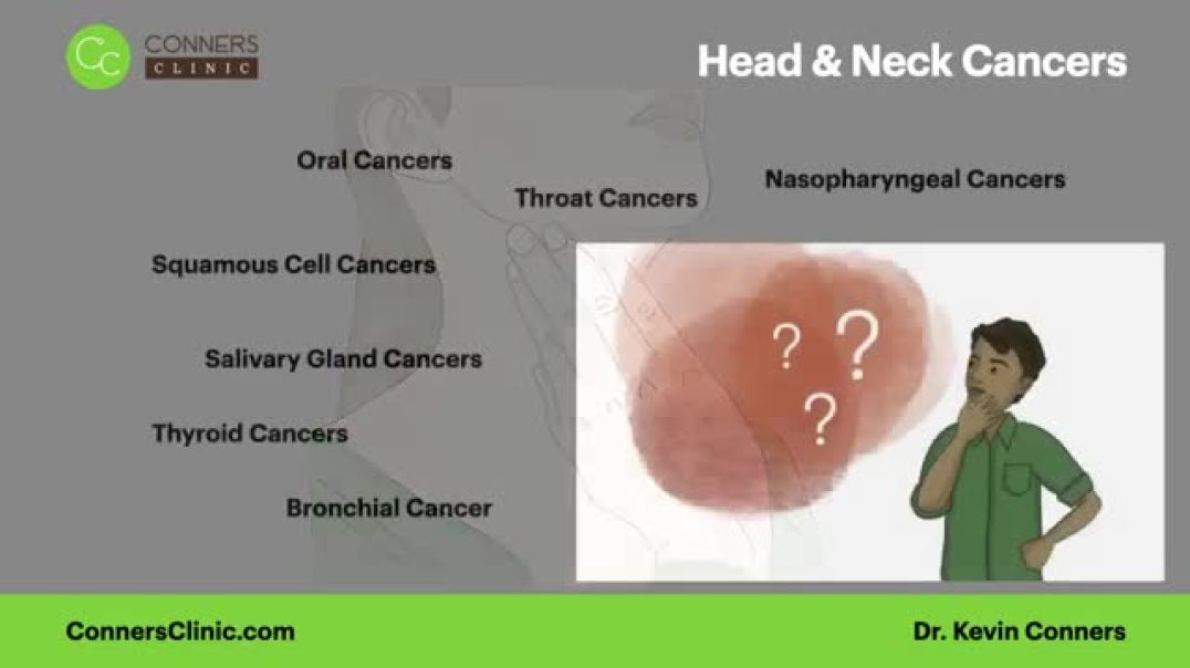 ⁣Head and Neck Cancers