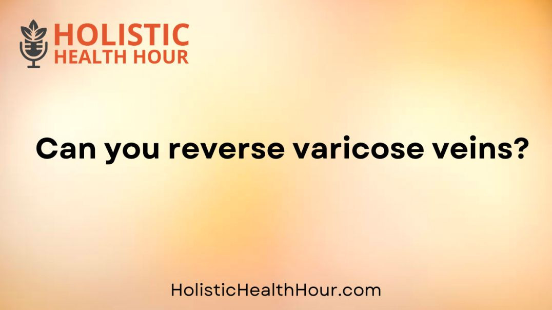 ⁣Can you reverse varicose veins?