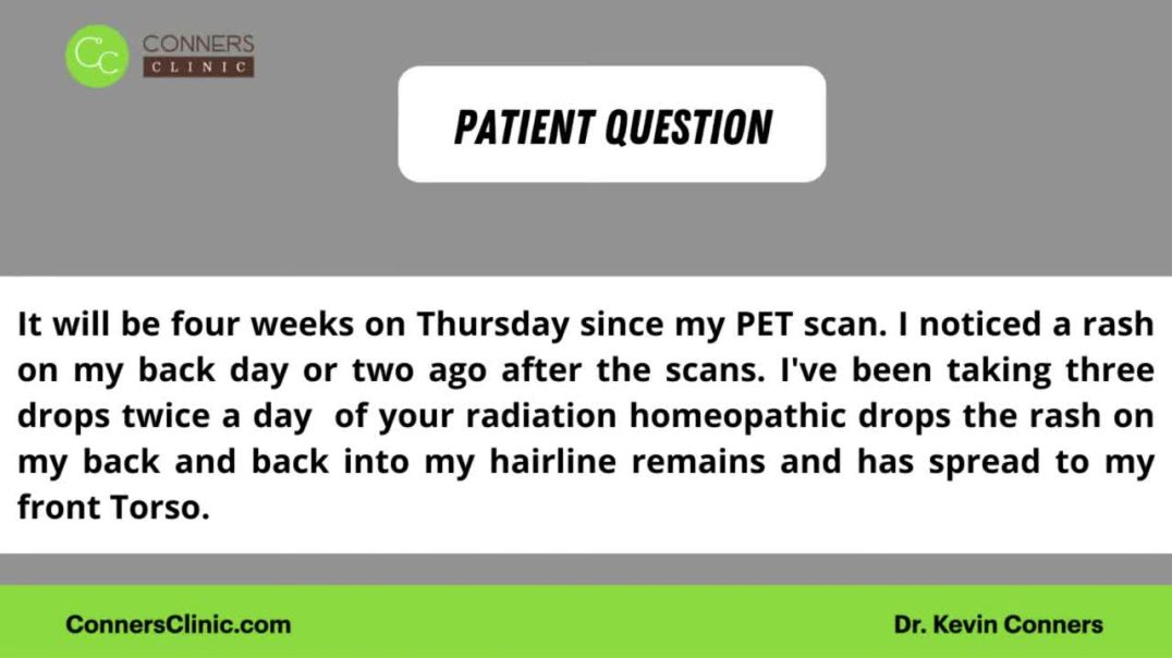 Rash after PET Scan