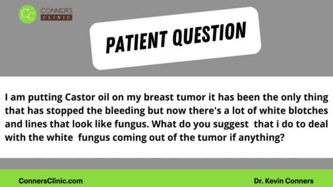 Castor Oil on a Breast Tumor