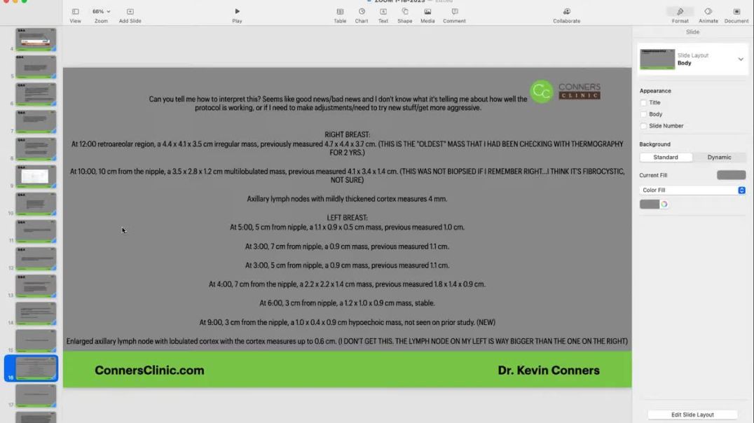 Reviewing a Breast Cancer Member's CT Scan Results